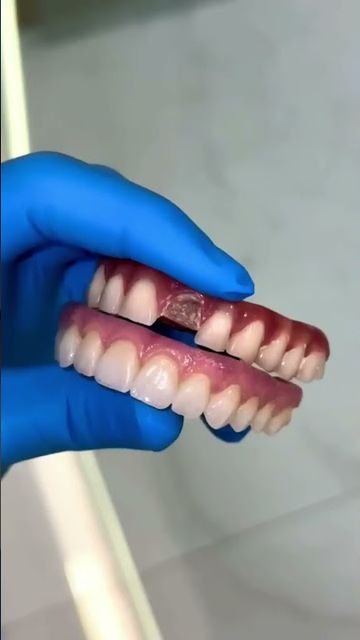 Prótese fixa em zircônia segurada pelo dentista